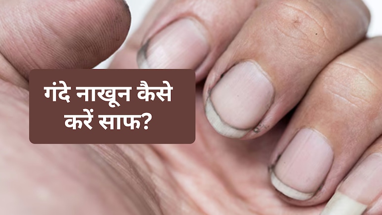 पीले पड़ गए नाखूनों को नींबू से करें ऐसे साफ, मोतियों की तरह चमक उठेंगे Nails