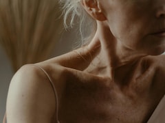 What Is Ozempic Neck? Causes, Signs And Can You Prevent It?