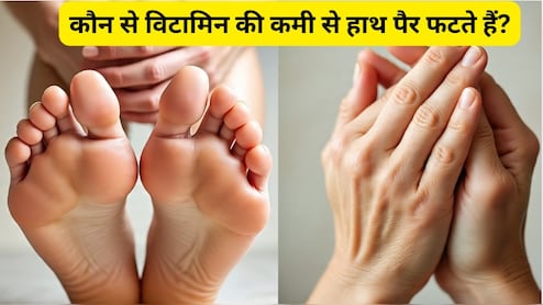 कौन से विटामिन की कमी से हाथ पैर फटते हैं?