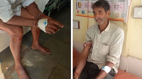 सीकर में तेंदुए का आतंक, खेत में काम कर रहे 2 ग्रामीणों पर किया हमला; दहशत में लोग