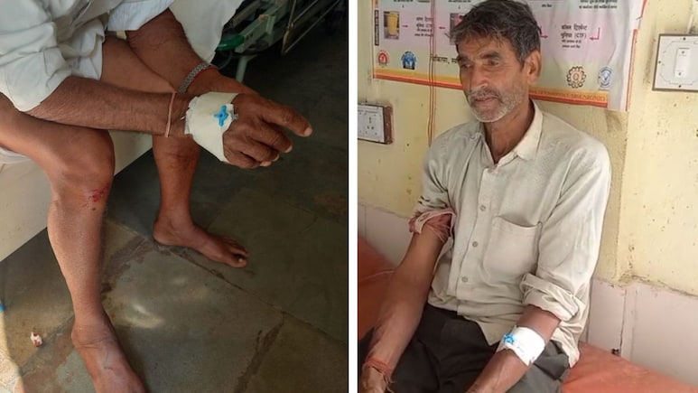 सीकर में तेंदुए का आतंक, खेत में काम कर रहे 2 ग्रामीणों पर किया हमला; दहशत में लोग