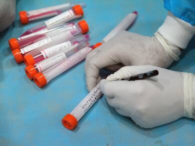 Coronavirus India Updates: Active Cases Continue To Drop, CDSCO Seeks More Vaccine Data