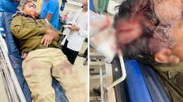 जयपुर में पुलिस टीम पर हमला, PCR के ASI गंभीर रूप से घायल