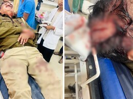 जयपुर में पुलिस टीम पर हमला, PCR के ASI गंभीर रूप से घायल