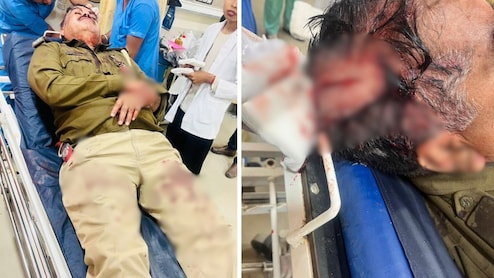 जयपुर में पुलिस टीम पर हमला, PCR के ASI गंभीर रूप से घायल