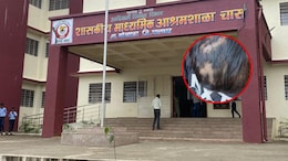 Palghar News: 8वीच्या विद्यार्थ्याला झोपेत केलं विद्रुप! पालकांना लेकराकडे बघणंही झालं कठीण, असं काय घडलं?