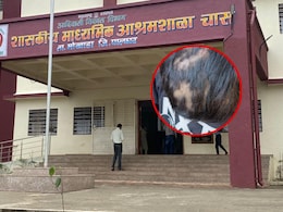 Palghar News: 8वीच्या विद्यार्थ्याला झोपेत केलं विद्रुप! पालकांना लेकराकडे बघणंही झालं कठीण, असं काय घडलं?