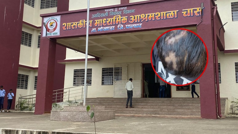 Palghar News: 8वीच्या विद्यार्थ्याला झोपेत केलं विद्रुप! पालकांना लेकराकडे बघणंही झालं कठीण, असं काय घडलं?
