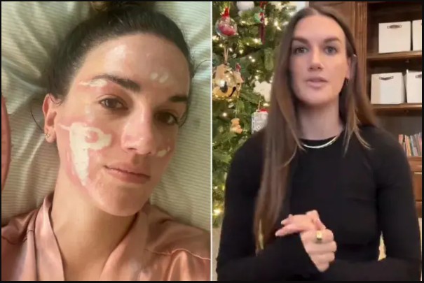 Priyanka Chopra's Facialist Sued For 31 Lakh By Woman Who Claims Chemical Peel 'Burned' Her Face