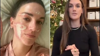 Priyanka's Facialist Sued For 31 Lakh By Woman Claiming Chemical Peel 'Burn'