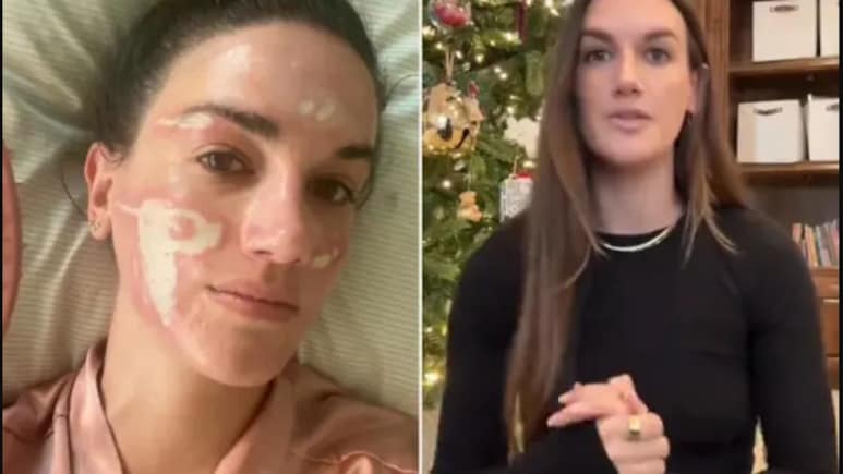 Priyanka Chopra's Facialist Sued For 31 Lakh By Woman Who Claims Chemical Peel 'Burned' Her Face