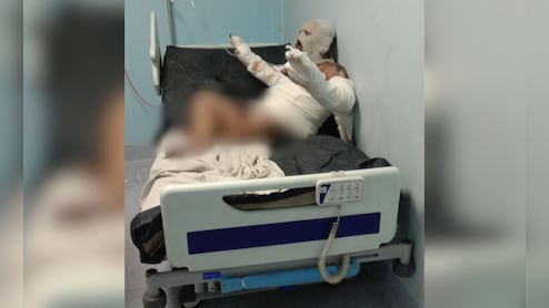 रायपुर में दंपती की घरेलू कलह का खौफनाक अंत, झगड़े में पत्नी ने पति को जलाया; इलाज के दौरान मौत