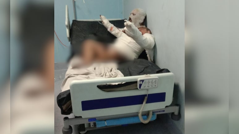 रायपुर में दंपती की घरेलू कलह का खौफनाक अंत, झगड़े में पत्नी ने पति को जलाया; इलाज के दौरान मौत