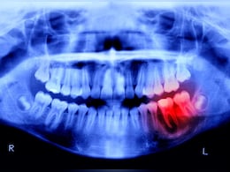 दांत टूट भी जाएं तो गम नहीं, अगले 4 साल में इंसान मुंह में फिर उगा सकेगा, जापान का चौंकाने वाला ट्रायल