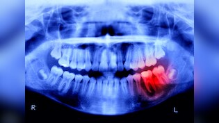 दांत टूट भी जाएं तो गम नहीं, अगले 4 साल में इंसान मुंह में फिर उगा सकेगा, जापान का चौंकाने वाला ट्रायल