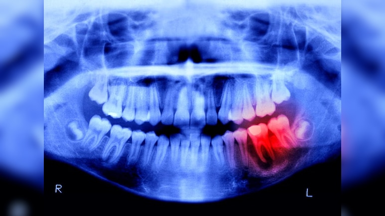 दांत टूट भी जाएं तो गम नहीं, अगले 4 साल में इंसान मुंह में फिर उगा सकेगा, जापान का चौंकाने वाला ट्रायल