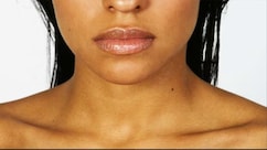 मेरी स्किन अचानक डार्क क्यों हो रही है? डर्मेटोलॉजिस्ट ने बताए 10 बड़े कारण, कहीं आप भी तो नहीं कर रहे हैं ये