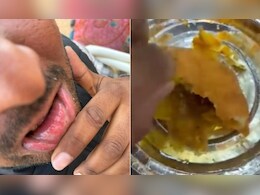 Rajasthan News: जोधपुर मिष्ठान भंडार की कचौरी में निकली ब्लेड, कोटपूतली में युवक का होंठ कटा