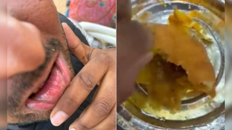 Rajasthan News: जोधपुर मिष्ठान भंडार की कचौरी में निकली ब्लेड, कोटपूतली में युवक का होंठ कटा