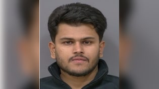 Indian-Origin Man Arrested In Canada For Flashing Female Doctors In Clinics