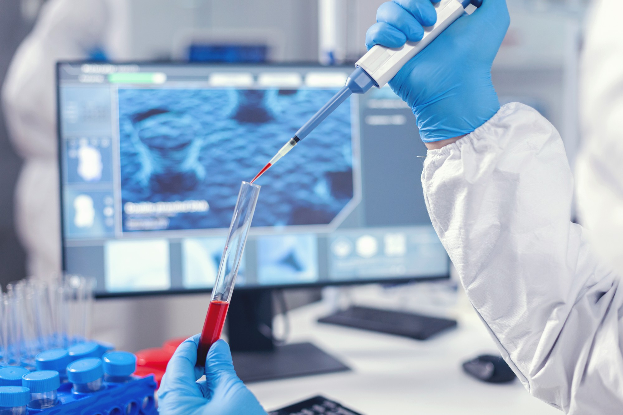Breast Cancer Drug Delivery Gets Precise Through Nano Injection Platform Developed By IIT Madras