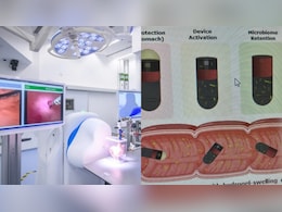 अब एंडोस्कोपी भूल जाइए! IIT दिल्ली का चमत्कारी कैप्सूल करेगा आंत की जांच और बताएगा अंदर का राज