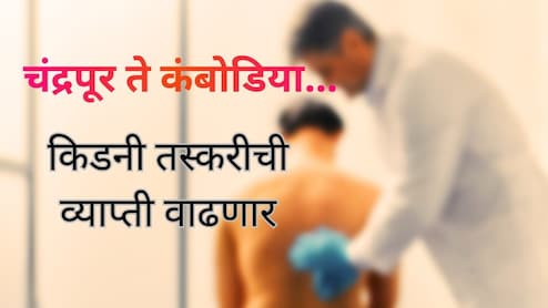 Chandrapur Kidney Case : किडनी विकली अन् रॅकेटमध्ये सहभागी झाले; भारतात तस्करीचं रॅकेट कसं चालतं?