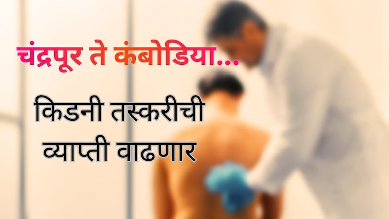 Chandrapur Kidney Case : किडनी विकली अन् रॅकेटमध्ये सहभागी झाले; भारतात तस्करीचं रॅकेट कसं चालतं?