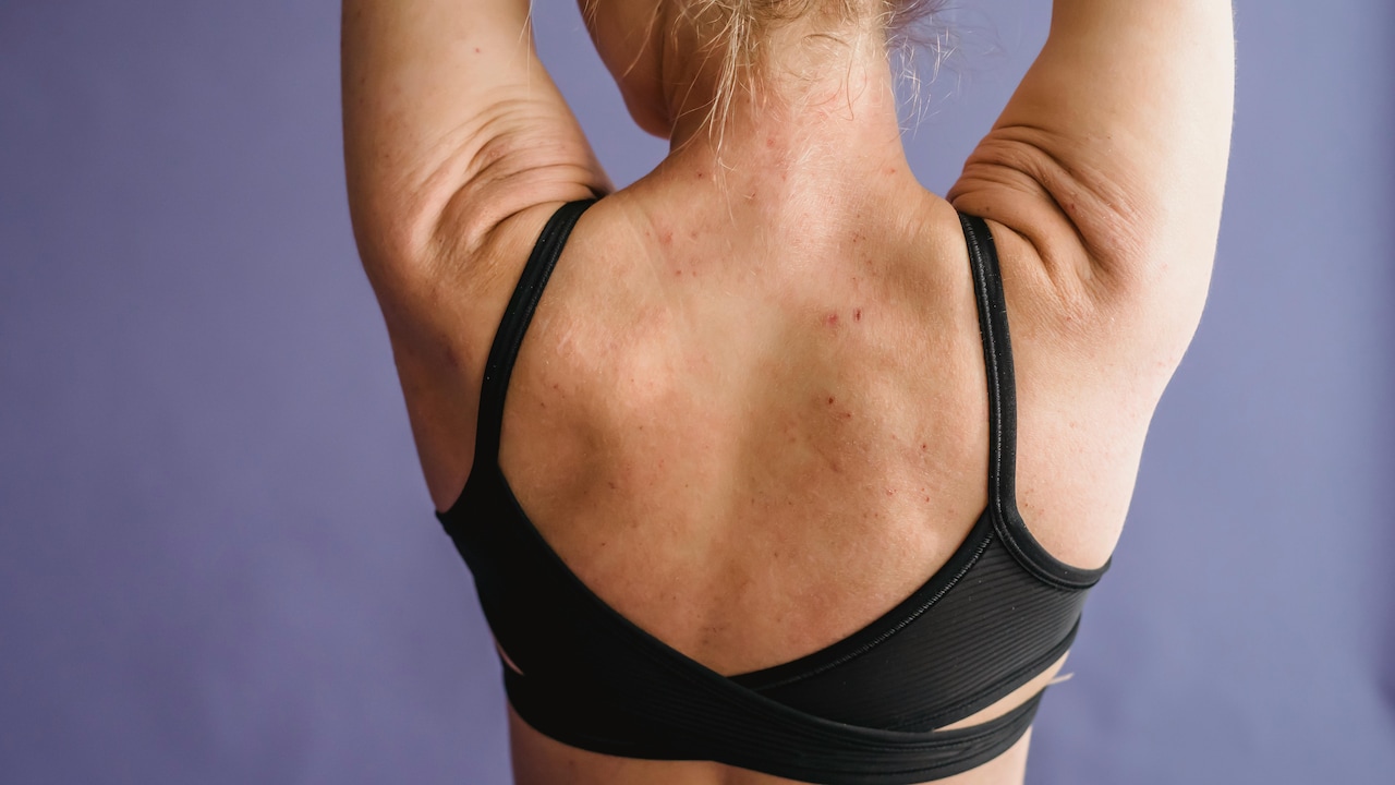 Bralette vs Bra: Whats the Difference and Which One Should You Wear?