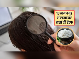 10 ग्राम कपूर से दूर हो जाएगी बालों की रूसी, डॉक्टर सुभाष गोयल ने बताया इस्तेमाल करने का सही तरीका