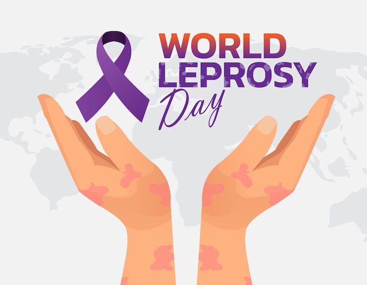 World Leprosy Day 2024: Date, Theme, History, Significance And More