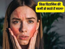 शरीर में किस विटामिन की कमी से सर्दियों में फटते हैं गाल, क्या खाने से होंगे ठीक