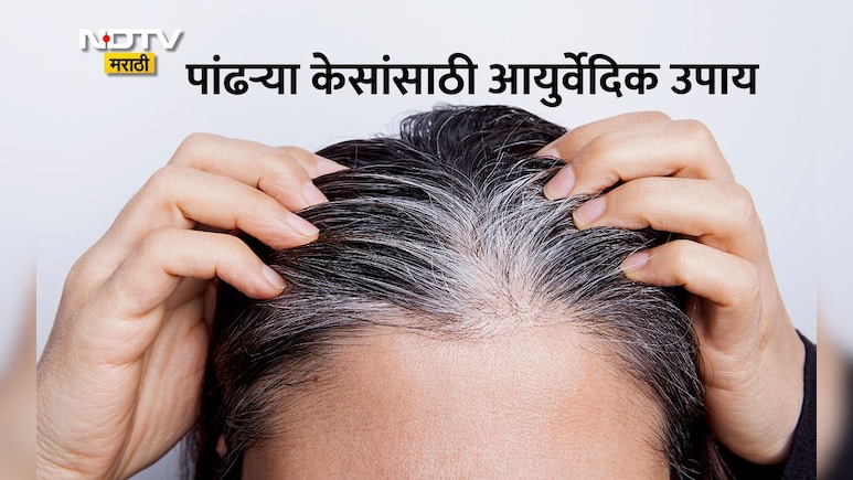 White Hair Remedies: केस अकाली पांढरे झाले आहेत? जाणून घ्या कारण आणि स्टेप बाय स्टेप आयुर्वेदिक रामबाण उपाय