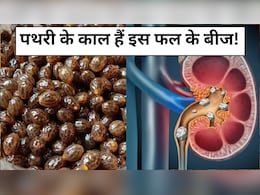पथरी को काट कर शरीर से बाहर कर देंगे इस फल के बीज, जानें कैसे करें सेवन