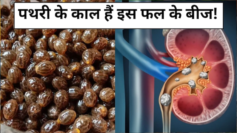 पथरी को काट कर शरीर से बाहर कर देंगे इस फल के बीज, जानें कैसे करें सेवन