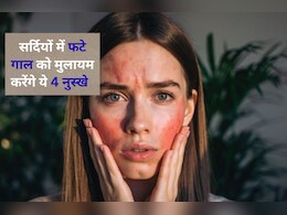 सर्दियों में फट गए हैं गाल? अपनाएं ये 4 नुस्खे, फिर से चिक्स हो जाएंगे मुलायम और चमकदार