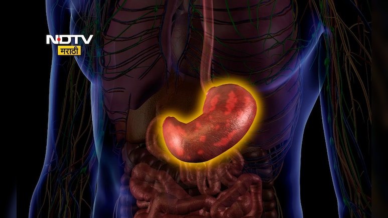 Acidity Bloating Relief Tips: पोटातील हवा कशी बाहेर काढावी? करा हे 3 उपाय, पोट फुगणं होईल बंद