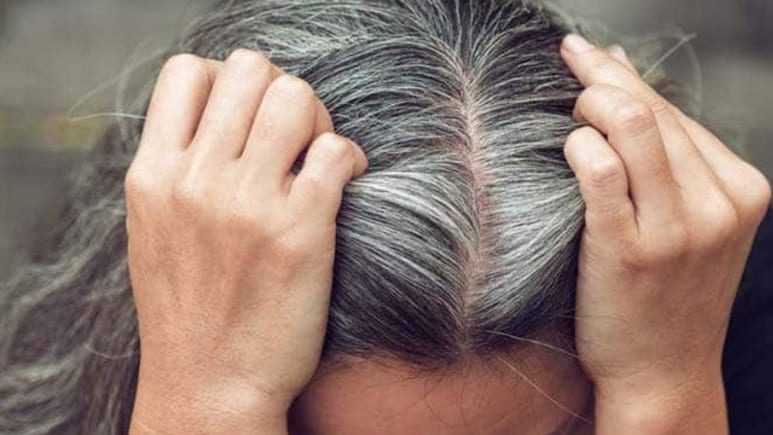 कम उम्र में ही बाल सफेद हो गए? आंवला, नारियल तेल और प्याज के रस समेत इन 5 तरीकों से फिर काले हो जाएंगे बाल