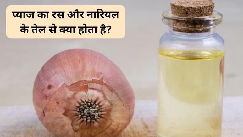 नारियल तेल को प्याज के रस के साथ मिलकर सिर में लगाने से क्या होगा? जानिए बालों की ग्रोथ पर इसका क्या असर होता है