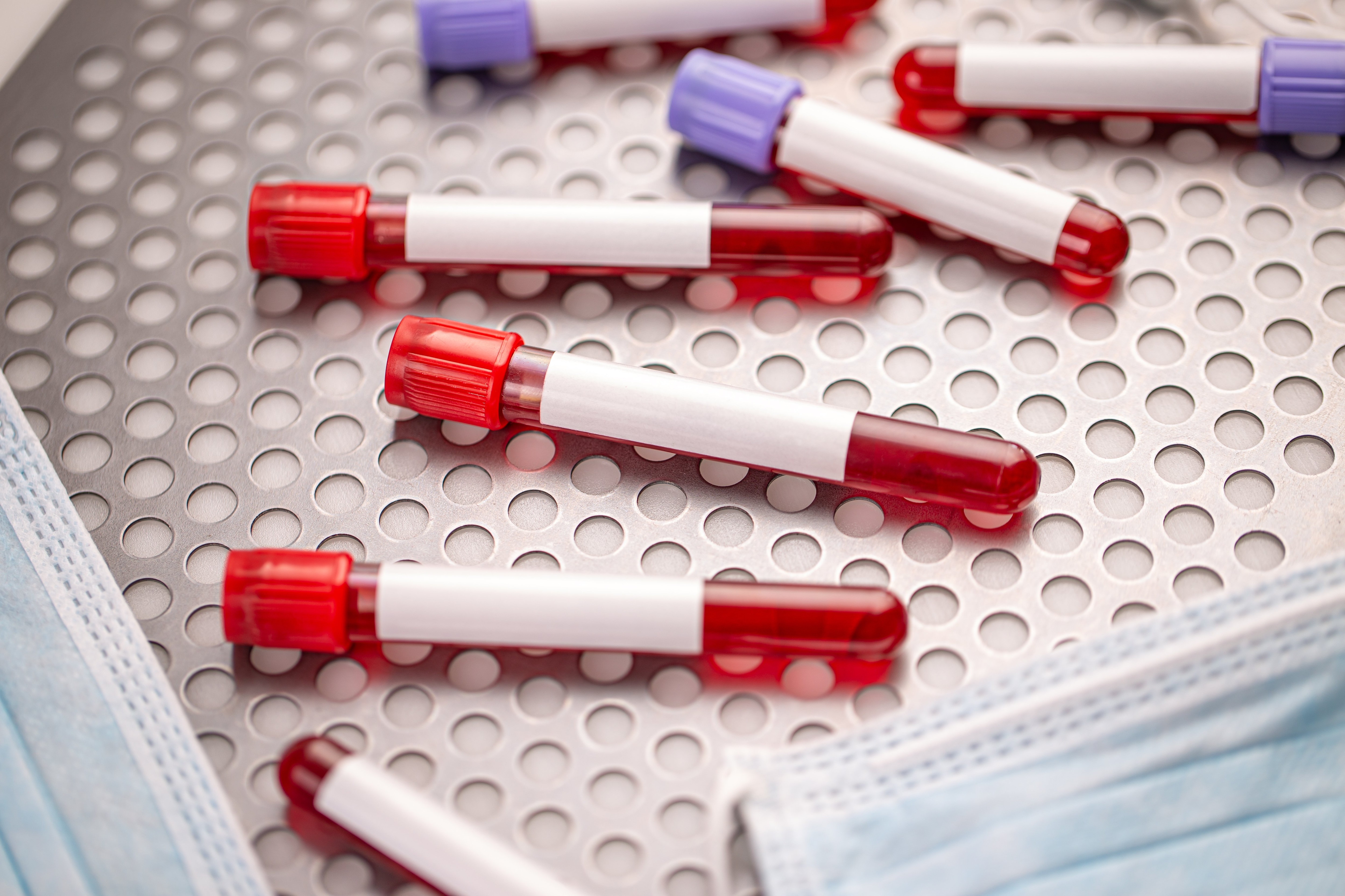 Vijaya Diagnostic Shares Upgraded By Yes Securities — Check Target Price, Potential Upside And More