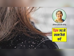 रूसी को जड़ से कैसे खत्म करें? डॉक्टर हंसाजी ने बताए 5 घरेलू नुस्खे, डैंड्रफ से तुरंत मिलेगा छुटकारा