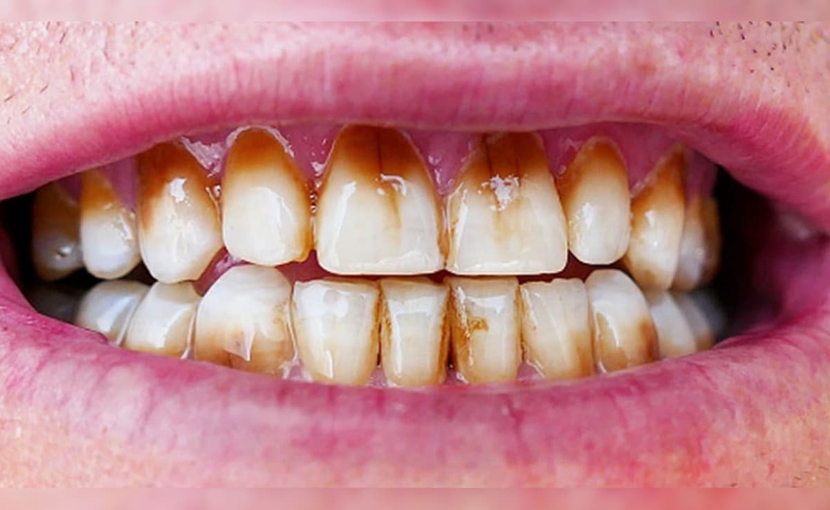 Latest and Breaking News on NDTV Latest and Breaking News on NDTV