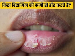 सर्दियों में किस विटामिन की कमी से फंटते हैं होंठ, आचार्य बालकृष्ण ने बताया कैसे बनाएं मुलायम और चमकदार