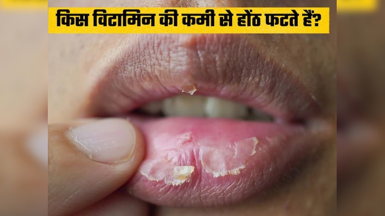 सर्दियों में किस विटामिन की कमी से फंटते हैं होंठ, आचार्य बालकृष्ण ने बताया कैसे बनाएं मुलायम और चमकदार