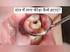 दांत में लगा कीड़ा या खोखला हो गया है दांत, तो अपनाएं Dr. Saleem Zaidiके बताएं ये नुस्खे, फिर से नए जैसा होगा
