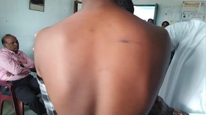 Telangana Class 10 Student Beaten With Sticks, Bats By Seniors In Hostel Room