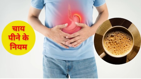 चाय पीते ही एसिडिटी और गैस बनने लगती है? तो जान लें चाय पीने के नियम, फिर कभी नहीं होगी ये दिक्कत