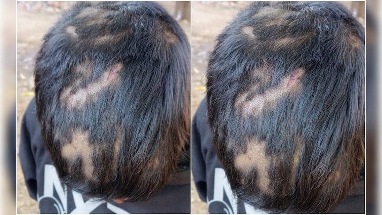 हॉस्टल में सो रहा था, सिर और भौहों के बाल काटे... पालघर में 14 साल के बच्चे के साथ ये कैसी हरकत