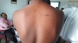 Telangana Class 10 Student Beaten With Sticks, Bats By Seniors In Hostel Room
