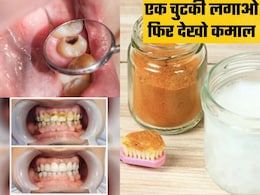 पीले दांत, मुंह की बदबू और दांतों के कीड़ों को बाहर निकाल देहा ये देसी मंजन, किचन की चीजों से बनाएं फिर देखें कमाल